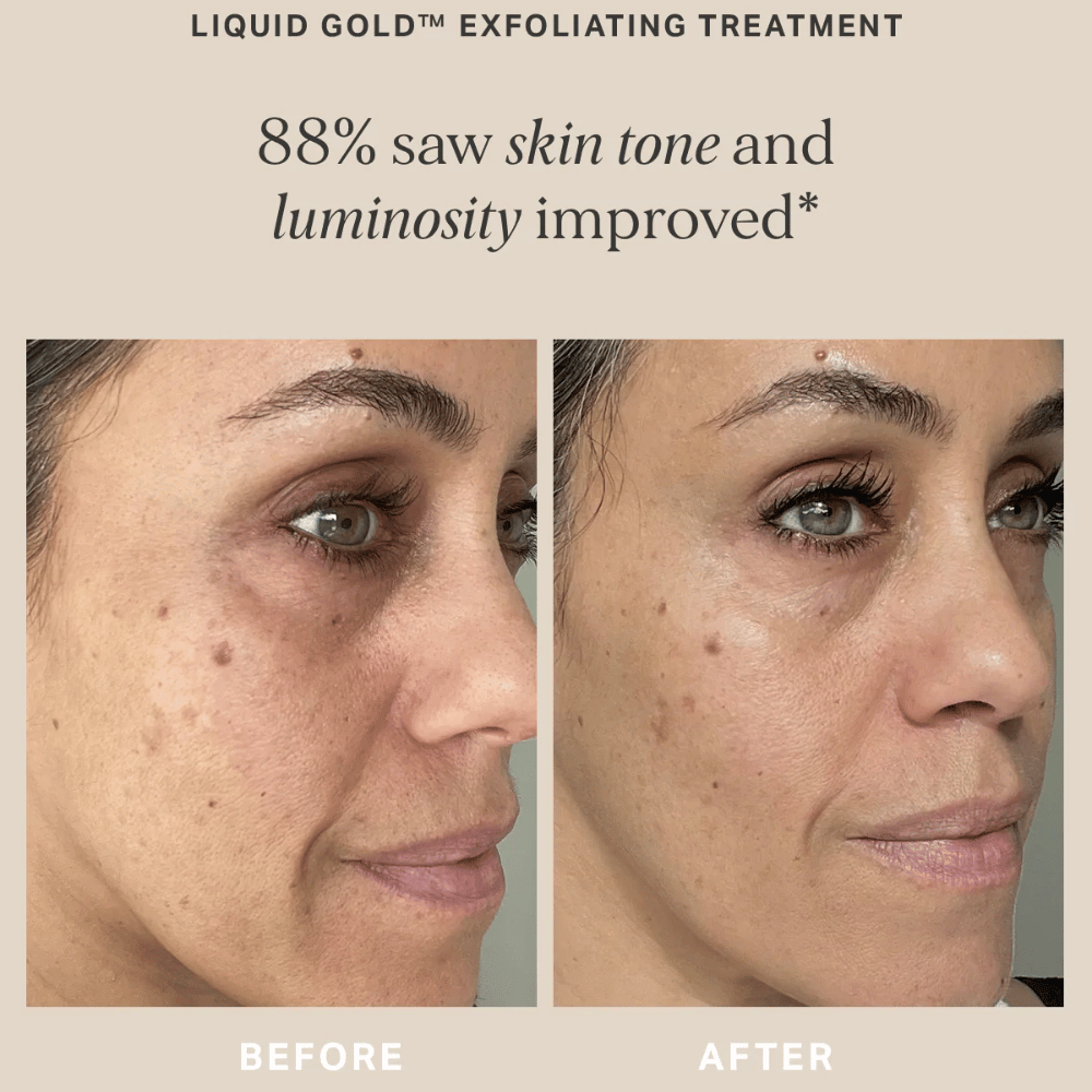 Alpha-H Liquid Gold with 5% Glycolic Acid - 100ml