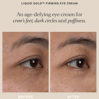 Alpha-H Liquid Gold Firming Eye Cream 15ml