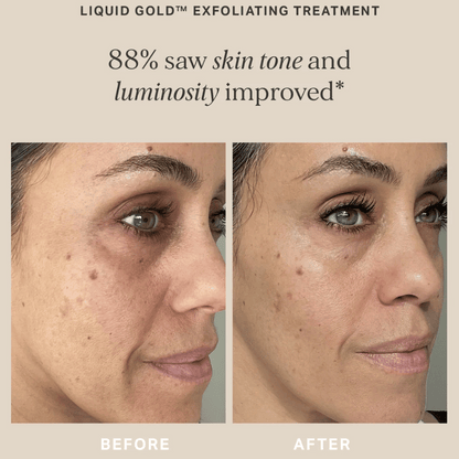Alpha-H Liquid Gold with 5% Glycolic Acid - 100ml